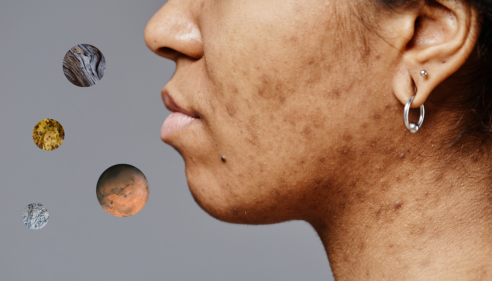 Pigmentation, Decoded: Why Multi-Omics Changes the Conversation