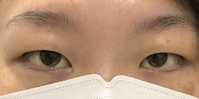 Before_埋没法.jpg