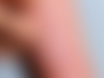 Eczema