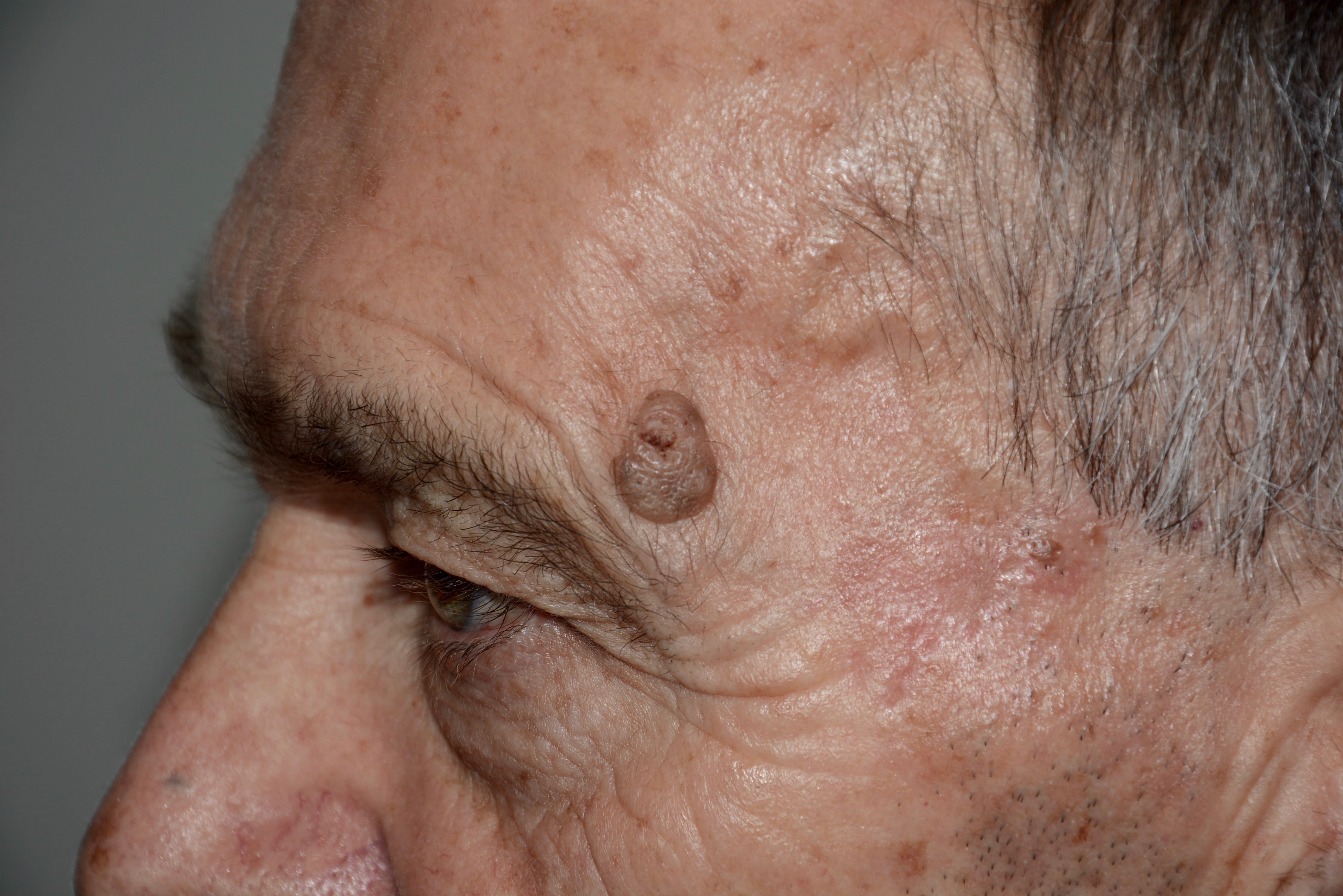 Liquid nitrogen drnraboobee1