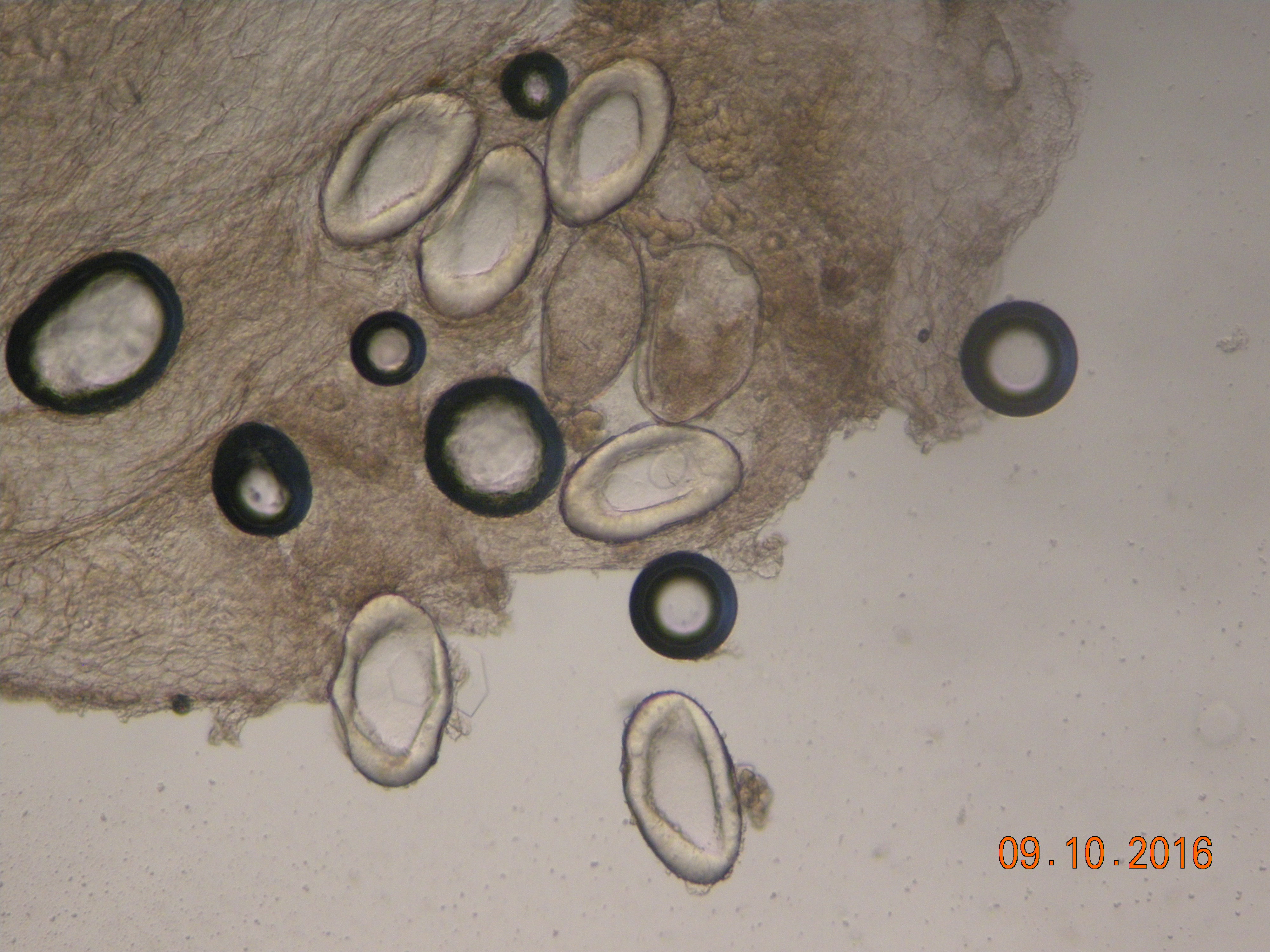 Scabies drnraboobee1