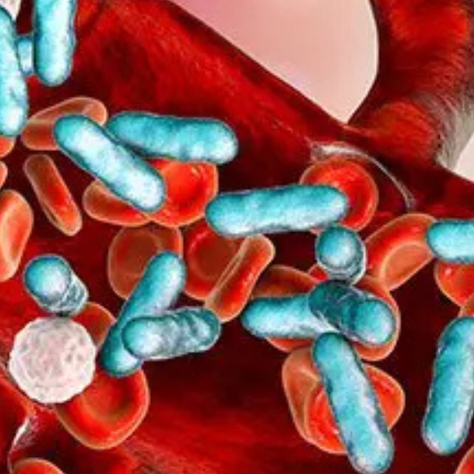 Sepsis