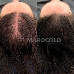 antes-depois-mulher.png
