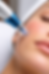 Microneedling procedure close-up on cheek.png