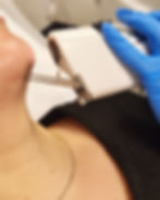 HÃ¥rborttagning haka