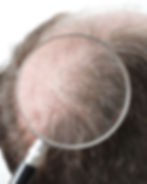 Huvud och förstoringsglas