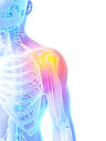 painful shoulder