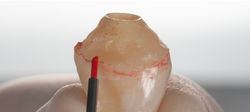 Handling of the anatomical temporary for