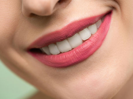 What Causes Yellow Teeth and How to Whiten Them?