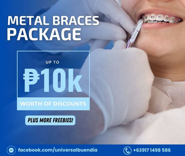 Orthodontic metal braces package with discounts, freebies, and up to Php10,000 off