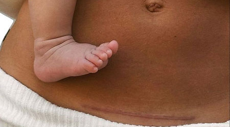 Accompagnement post-partum en massage bien-être jeune maman