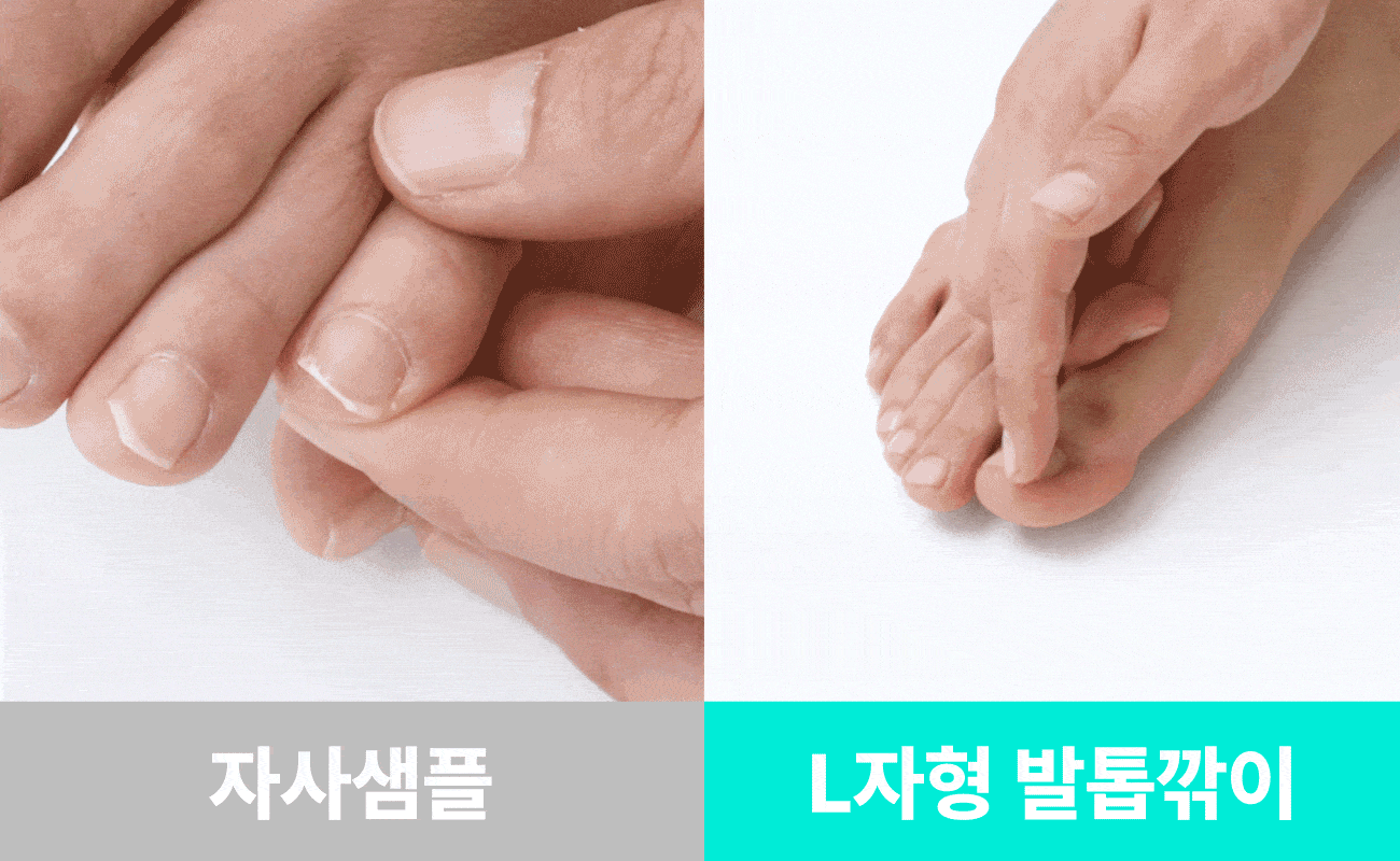 34.발톱비교.gif