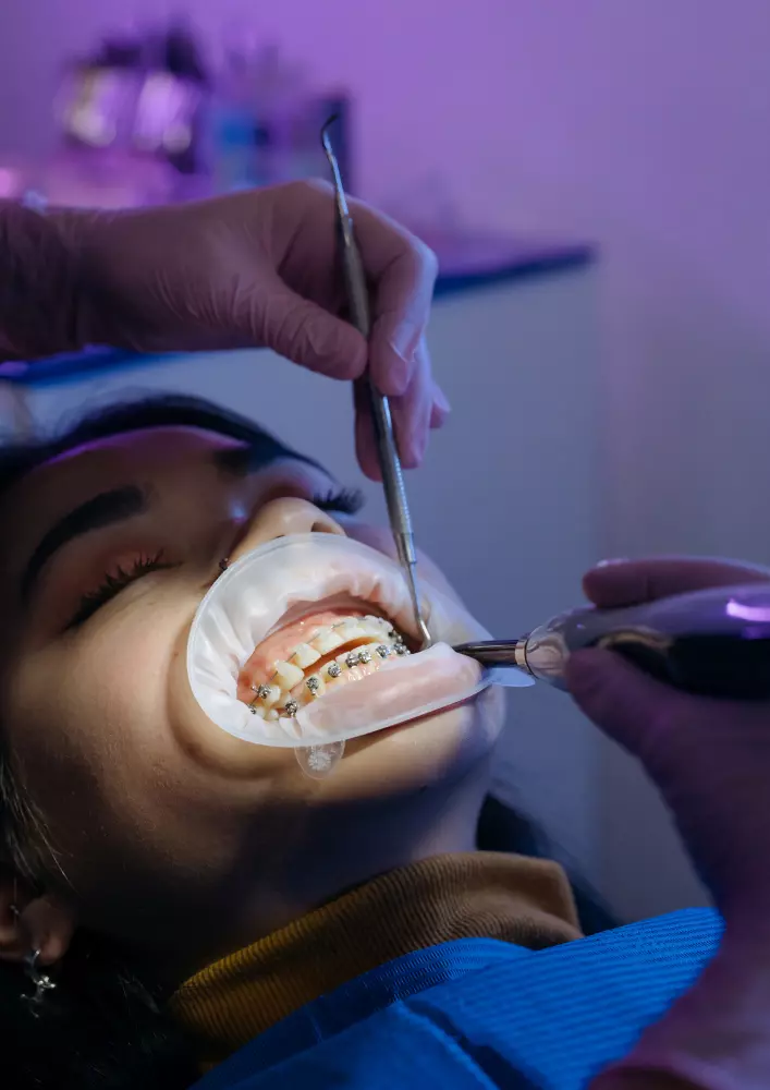Zirconium Crown in Izmir, Turkey Deva Dental Clinic