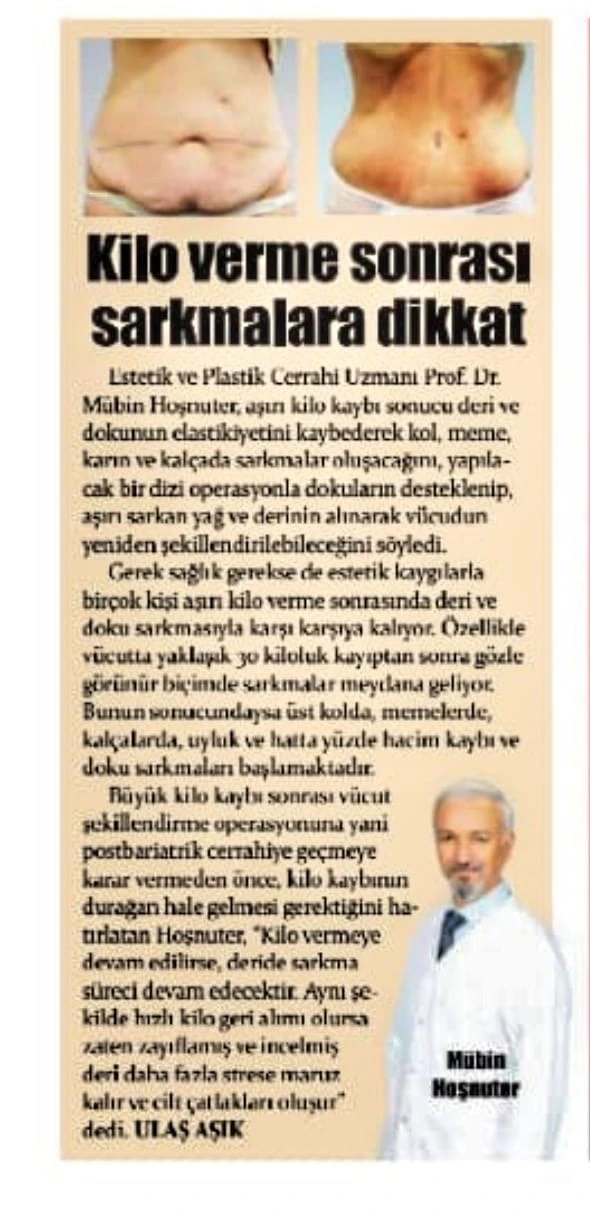 3d lazer lipoliz kadınlar kulübü
