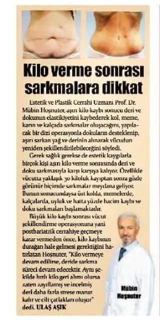 3d lazer lipoliz kadınlar kulübü