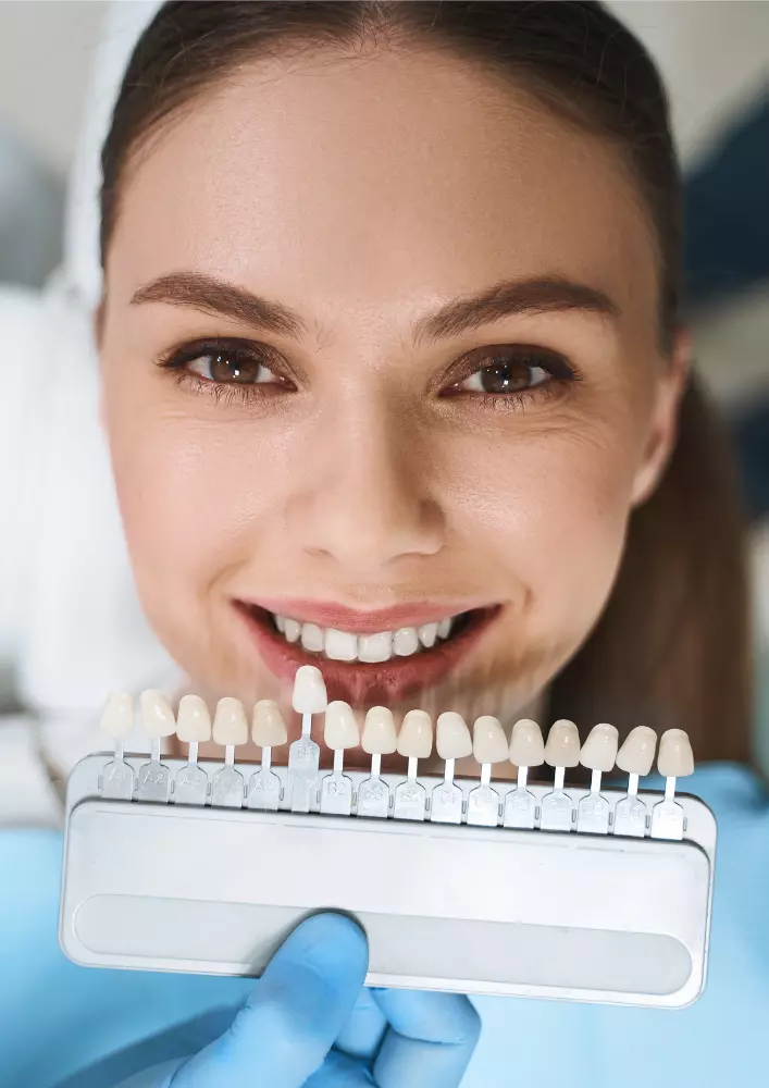 Laminate Veneer in Izmir, Turkey Deva Dental Clinic