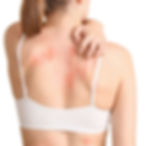 Allergic Skin Disease - Get Your Quote Now