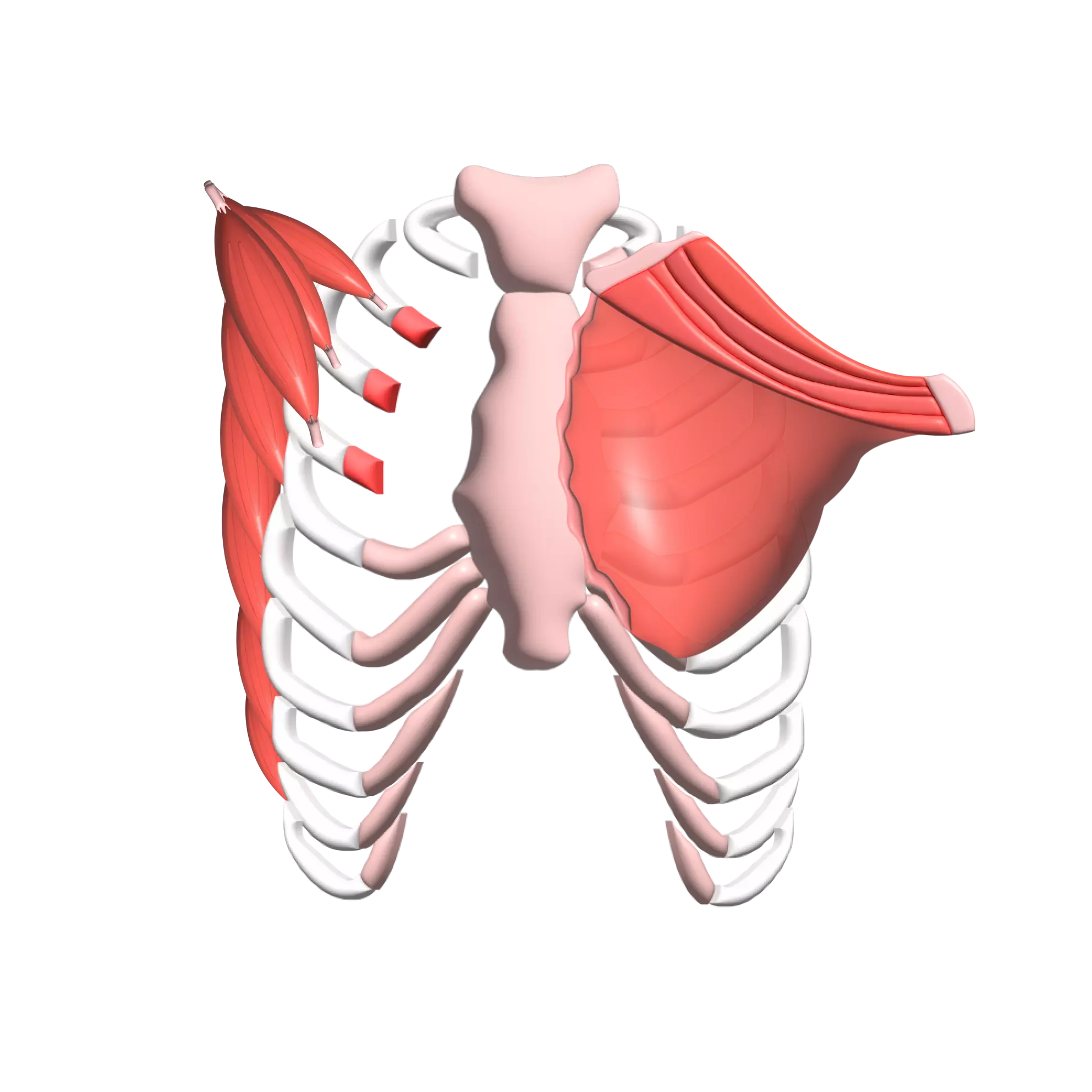 Poland Syndrome - Dr. Pectus