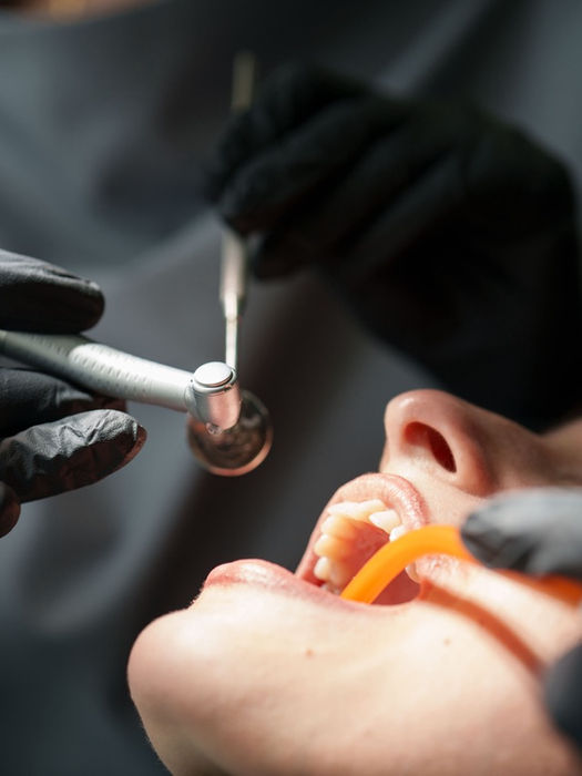 eskişehir implant diş fiyat