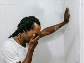 Varicocele: The often ignored groin discomfort in men that is easily treatable