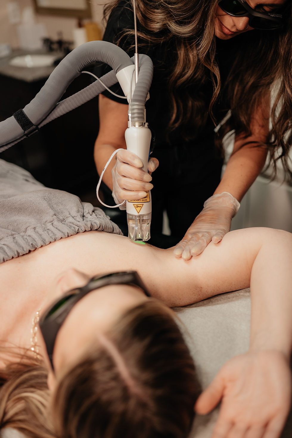 Client receiving underarm laser hair removal treatment while wearing protective goggles.