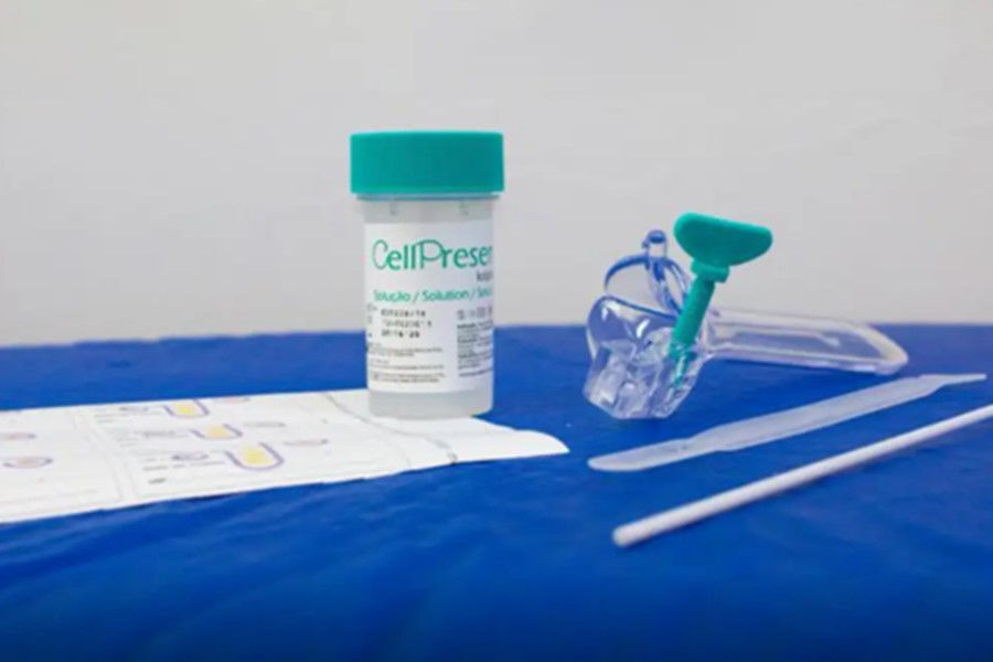 JNHOJE - Saiba como é o novo teste do SUS para detectar câncer do colo do útero