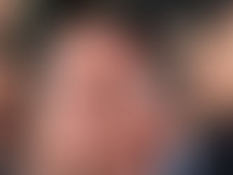 JNHOJE - Defesa de Bolsonaro pede liberação para cirurgia urgente