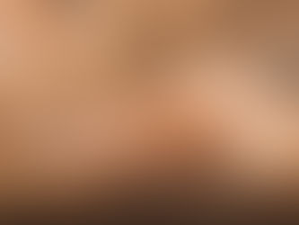 THE TRUTH ABOUT LASERS, PART 3: WHAT YOUR SKIN REALLY NEEDS