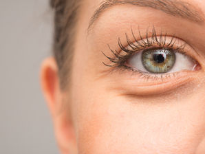 UNDER EYE BAGS VS. UNDER EYE PUFFINESS: WHAT'S THE DIFFERENCE?