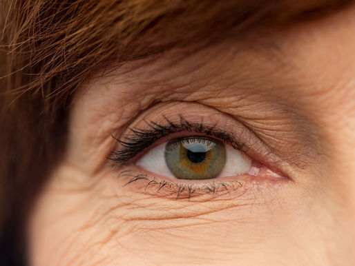 Wechseljahre Hautveränderung