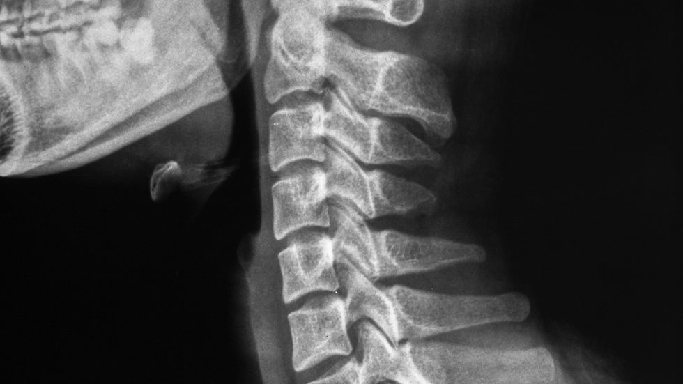¿Para qué se utilizan las radiografías en la quiropráctica?