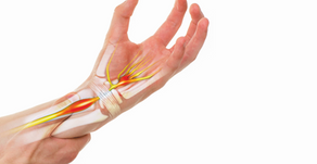¿Realmente Tengo “Carpal Tunnel”?