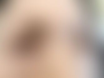 リフトアップ〜⬆︎⬆︎