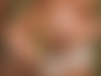 ¿Estrías? ¡Descubre el secreto para deshacerte de ellas en semanas!