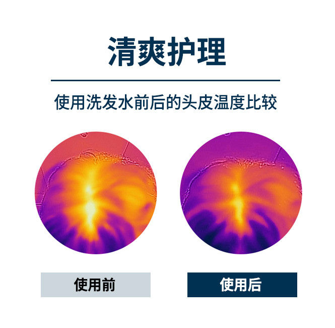 縮圖：吕 脱发护理弱发洗发水 RYO Hair Loss Care Shampoo For Weak Hair 400ml