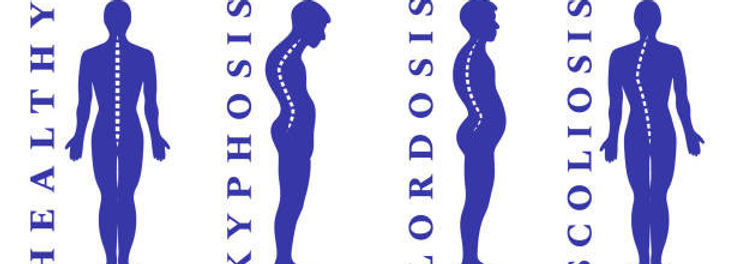 Spinal Asymmetries Consulting