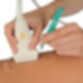 Ultrasound guided injections