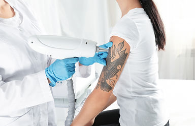 Woman undergoing laser tattoo removal procedure in salon.jpg