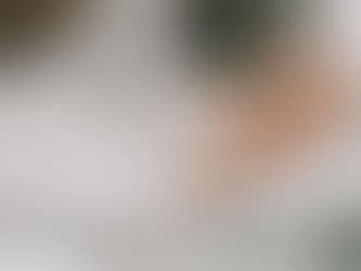 I'm A Surgeon ― Shiny Skin On Your Lower Legs Can Reveal Heart Health Issues