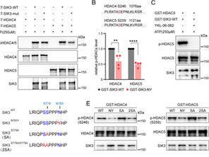 [Journal clubs] Jun 12,2025 [The SIK3-N783Y mutation is associated with the human natural short sleep trait]