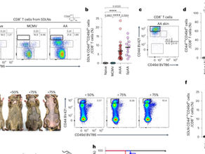 [Journal clubs] May 1,2025 [A virtual memory CD8+ T cell-originated subset causes alopecia areata through innate-like cytotoxicity]