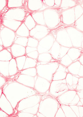 Enzymes under microscope