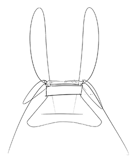 000PCT Product Concept