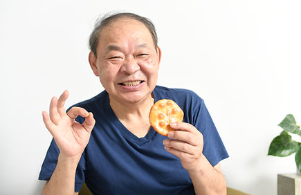 ノンクラスプデンチャー(自由診療)