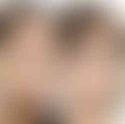 รีวิวศัลยกรรมเกาหลี