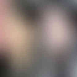 รีวิวศัลยกรรมเกาหลี