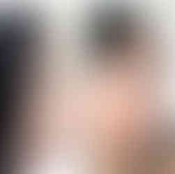 รีวิวศัลยกรรมเกาหลี