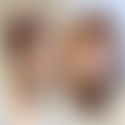 รีวิวศัลยกรรมเกาหลี