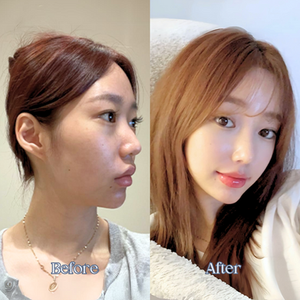 รีวิวศัลยกรรมเกาหลี