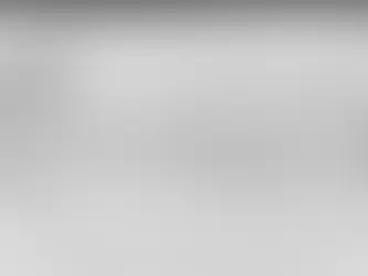 Бууны нурууны хазайлт